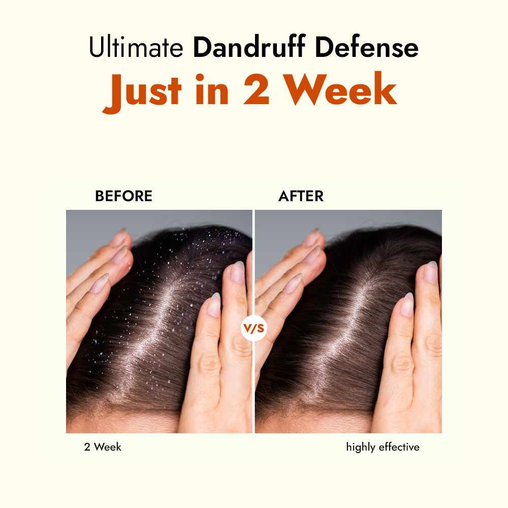 Dandruff Care Shampoo with Salicylic & Tea Tree