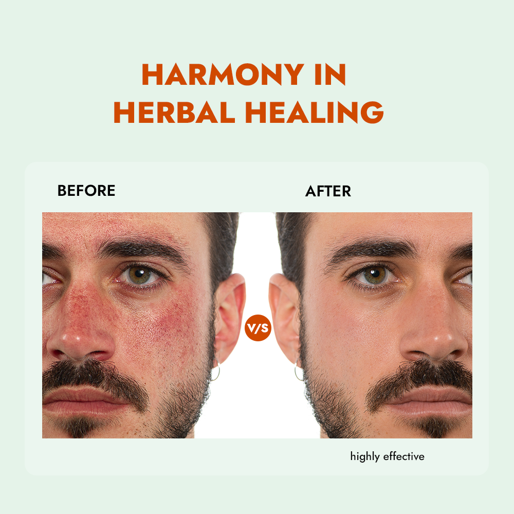 Herbal Face Wash with Mulberry & Tea Tree