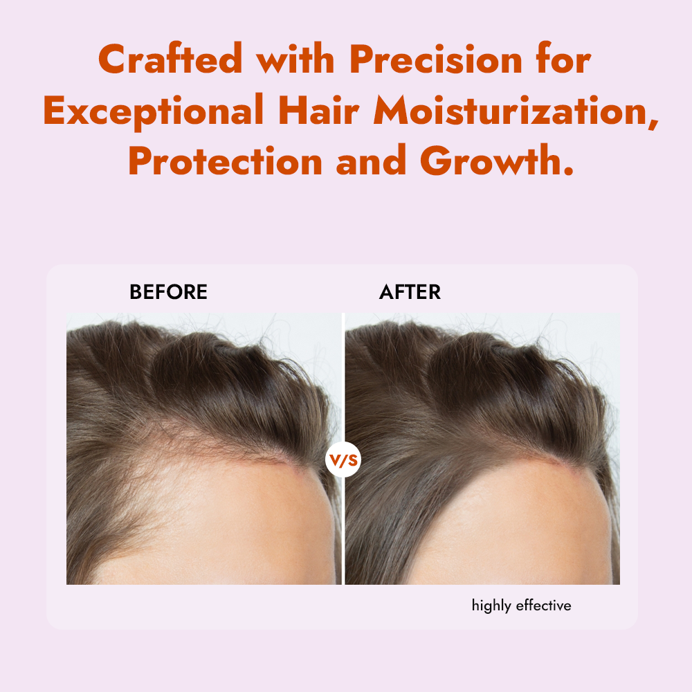 Onion Black Seed Shampoo – Strength & Nourish