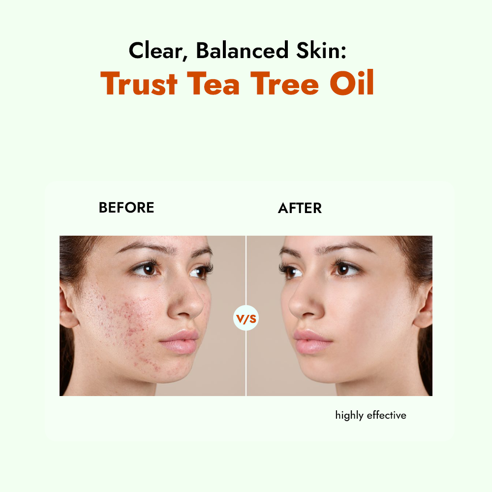 Tea Tree Oil Face Wash for Acne & Oil Control